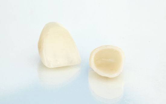 Who Is A Good Candidate For Dental Crowns