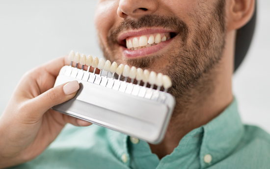 Candidate For Porcelain Veneers