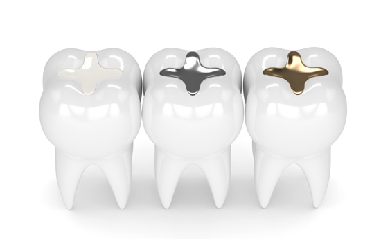 A Dental Filling Is A Restoration