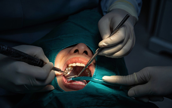 What Happens During Gum Periodontal Treatment