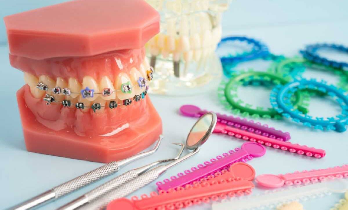 does cigna cover braces