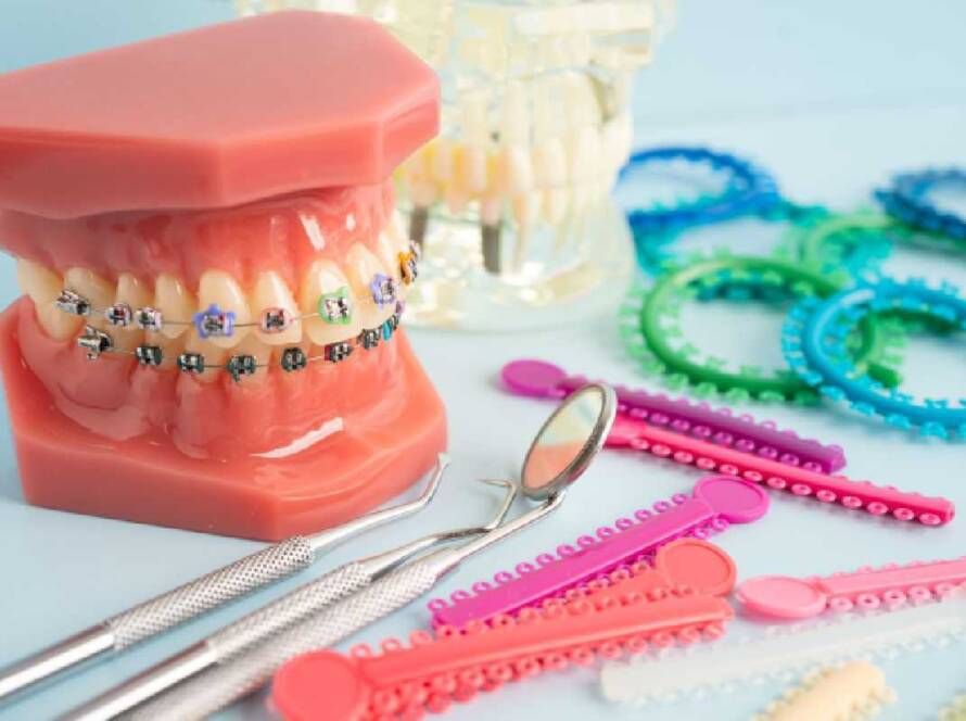 does cigna cover braces