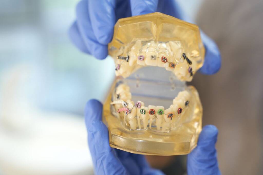 Does Invisalign Hurt? What to Expect and How to Manage Discomfort
