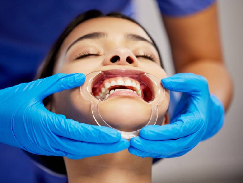 How Long Does Invisalign Take to Work? What to Expect From Start to Finish